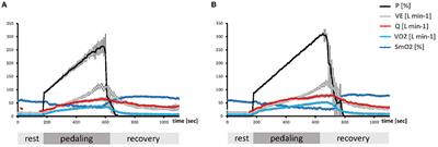 Variability in the Aerobic Fitness-Related Dependence on Respiratory Processes During Muscle Work Is Associated With the ACE-I/D Genotype